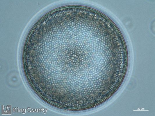 Photo of Coscinodiscus spp.